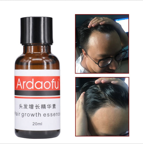 Ardaofu Hair Growth Essence, 20ml